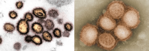 Influenza (Flu) verse Corona Virus (COVID-19)